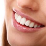 The Perfect Smile: Transforming Your Smile in Dubai 2024