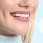 The Ultimate Guide to Dental Implants in Dubai 2024
