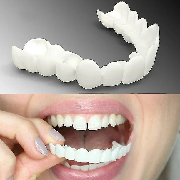 Dental Veneer