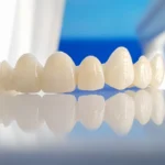 Zirconium Crowns for Front Teeth